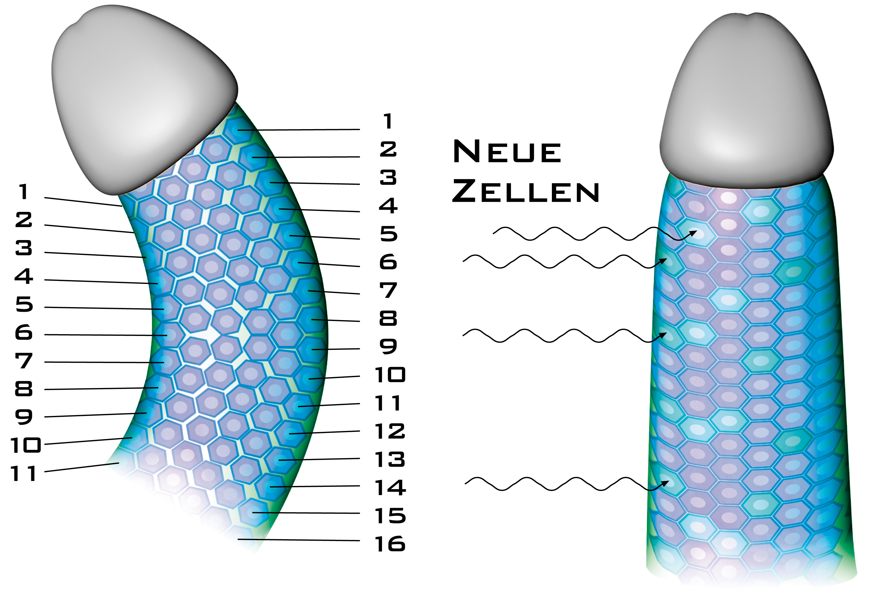 Functional illustration of the process of straightening the penis with PeniMaster