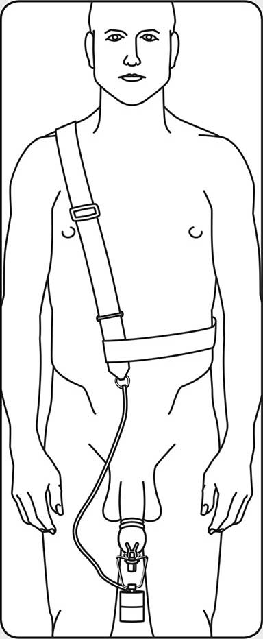 PeniMaster PRO weight expander correctly applied.